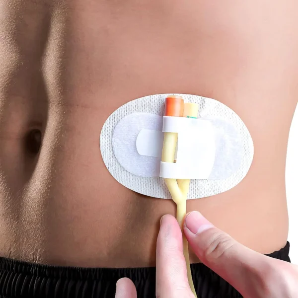 Catheter Holder Legband Sticker Tube Fixing Device