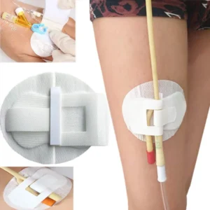Catheter leg strap holder secures feeding tubes comfortably to the abdomen, eliminating the need for pins and tape and preventing accidental pull-out.