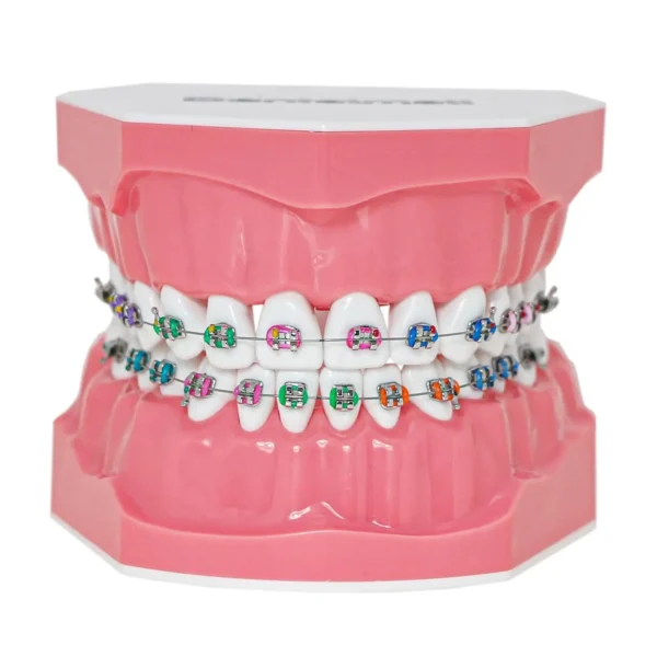 Dental Orthodontic Model Teeth Braces Demonstration