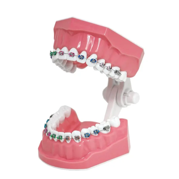 Dental Orthodontic Model Teeth Braces Demonstration