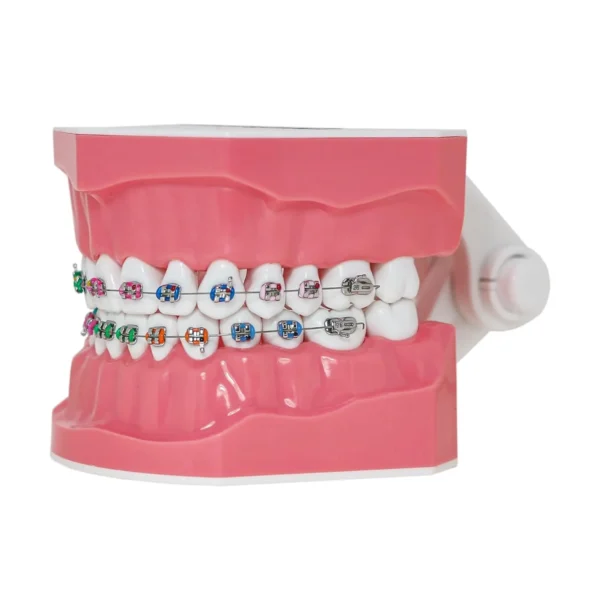 Dental Orthodontic Model Teeth Braces Demonstration