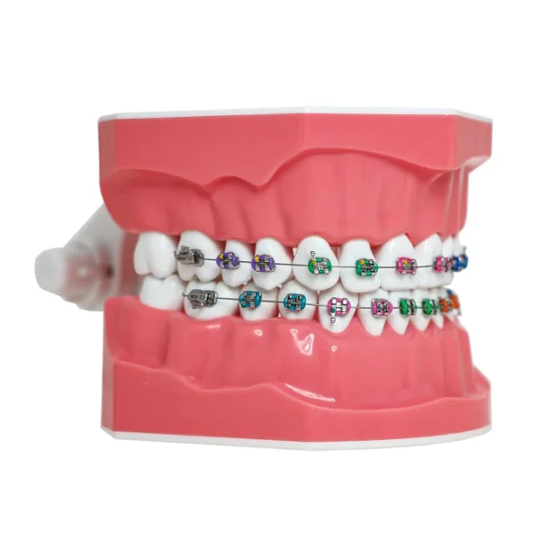 Dental Orthodontic Model Teeth Braces Demonstration