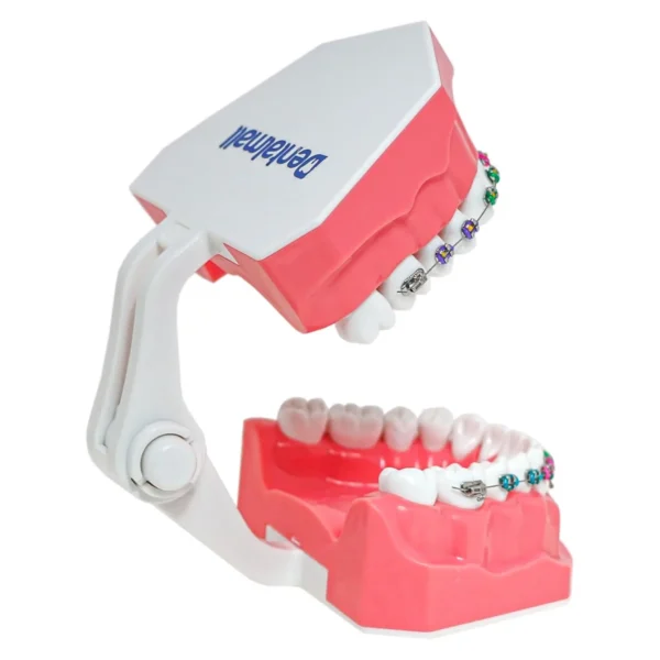 Dental Orthodontic Model Teeth Braces Demonstration