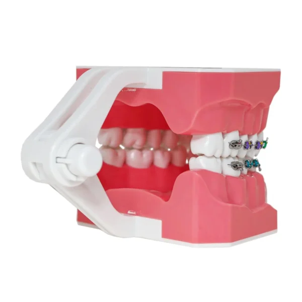 Dental Orthodontic Model Teeth Braces Demonstration